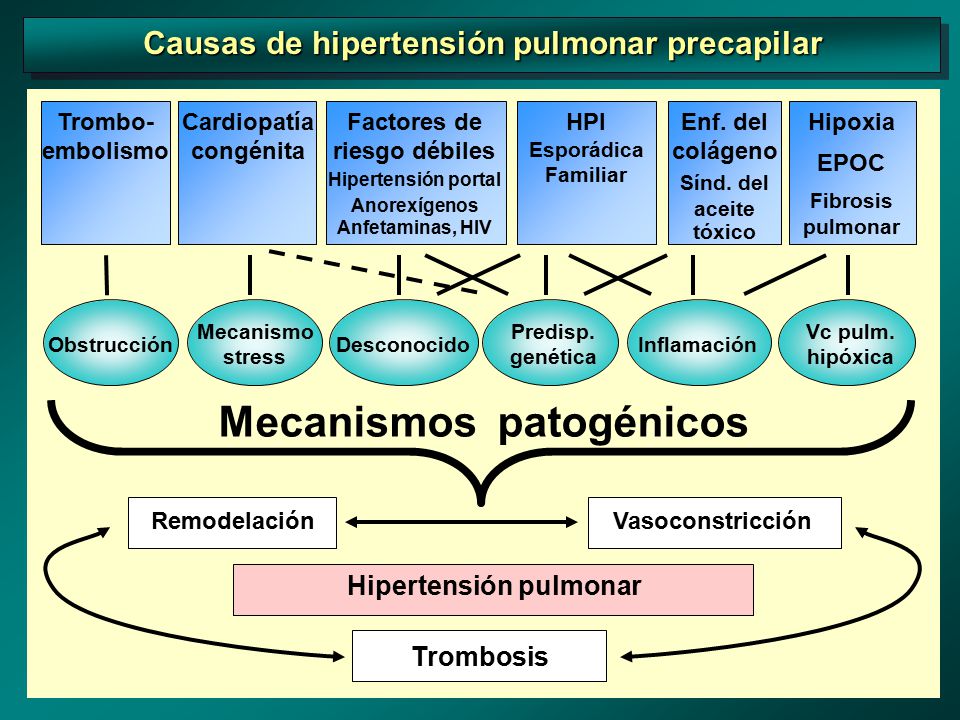 Causa de hipertensión venosa pulmonar